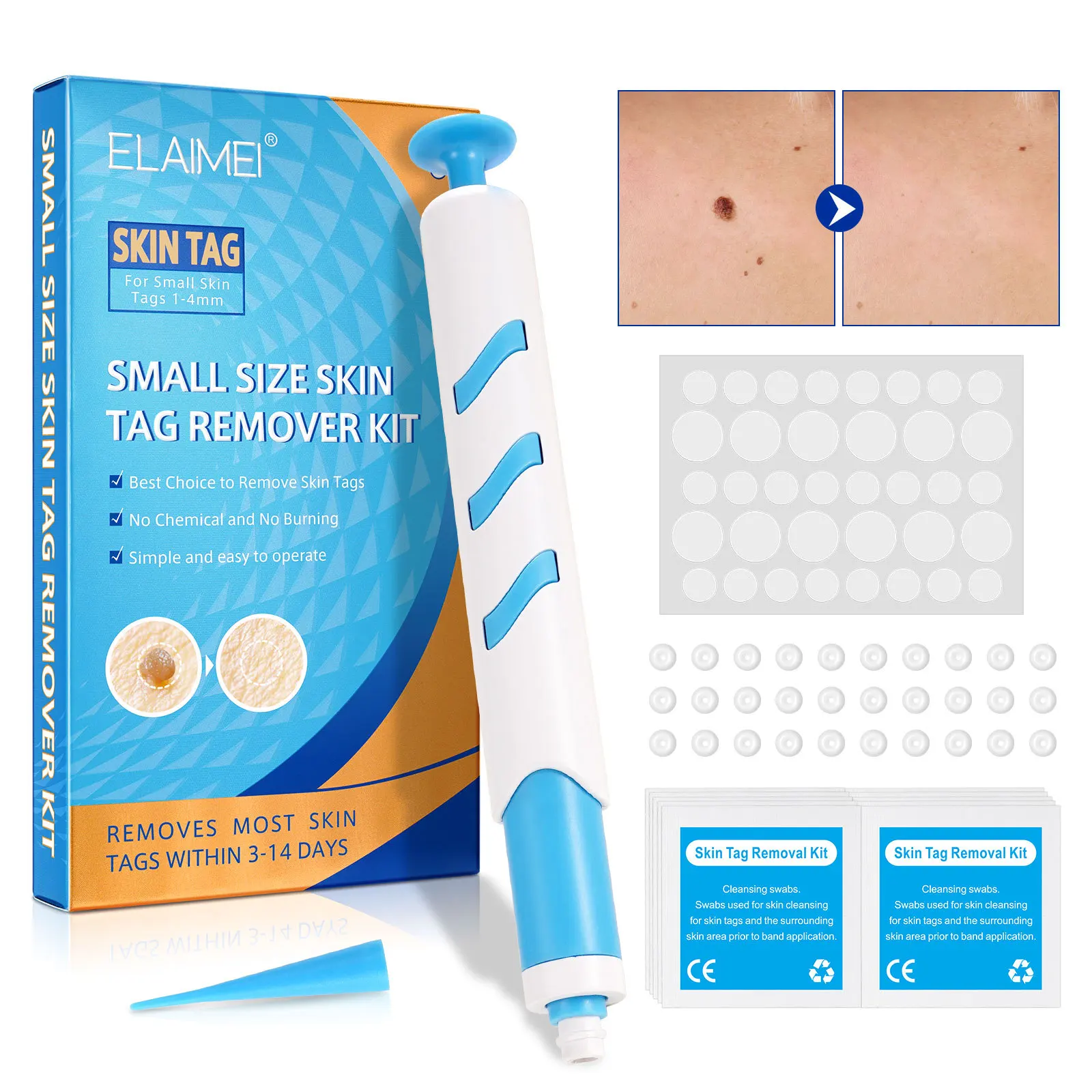 

Skin Tag Removal Mole Small Wart Removal Facial Mole Wart Microstrip Tag Removal Kit Automatic Mole Remover Tool