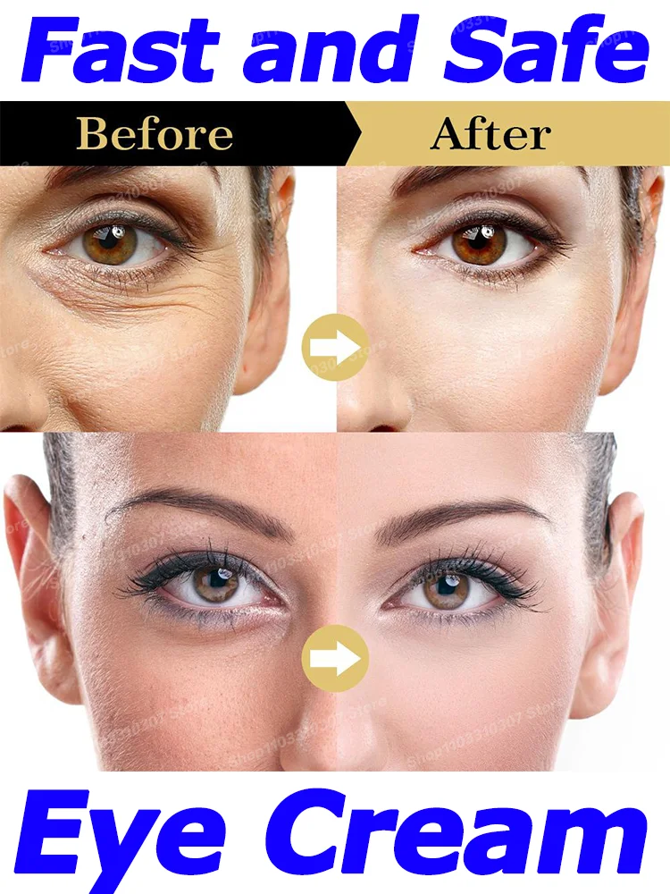 Eye cream Remove bags Puffiness away work under eyes