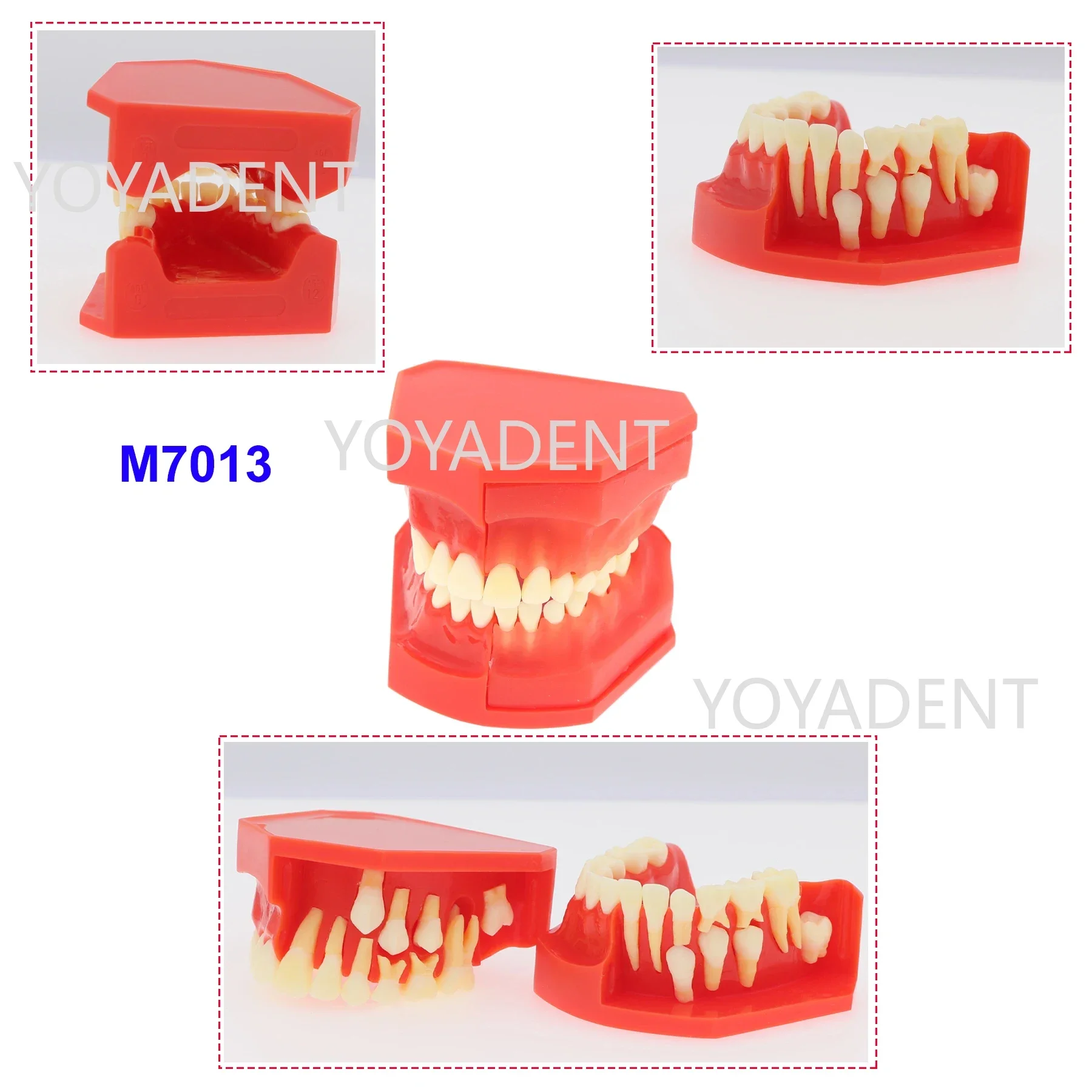 Dental Teeth Model  Children Primary Permanent Tooth Model  Constant Teeth Grow Replace Demo FalseTeeth