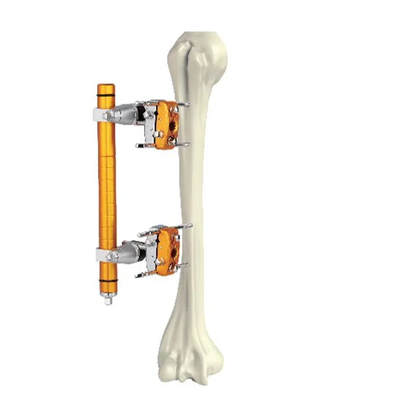 Orthopedic Humerus Fixator