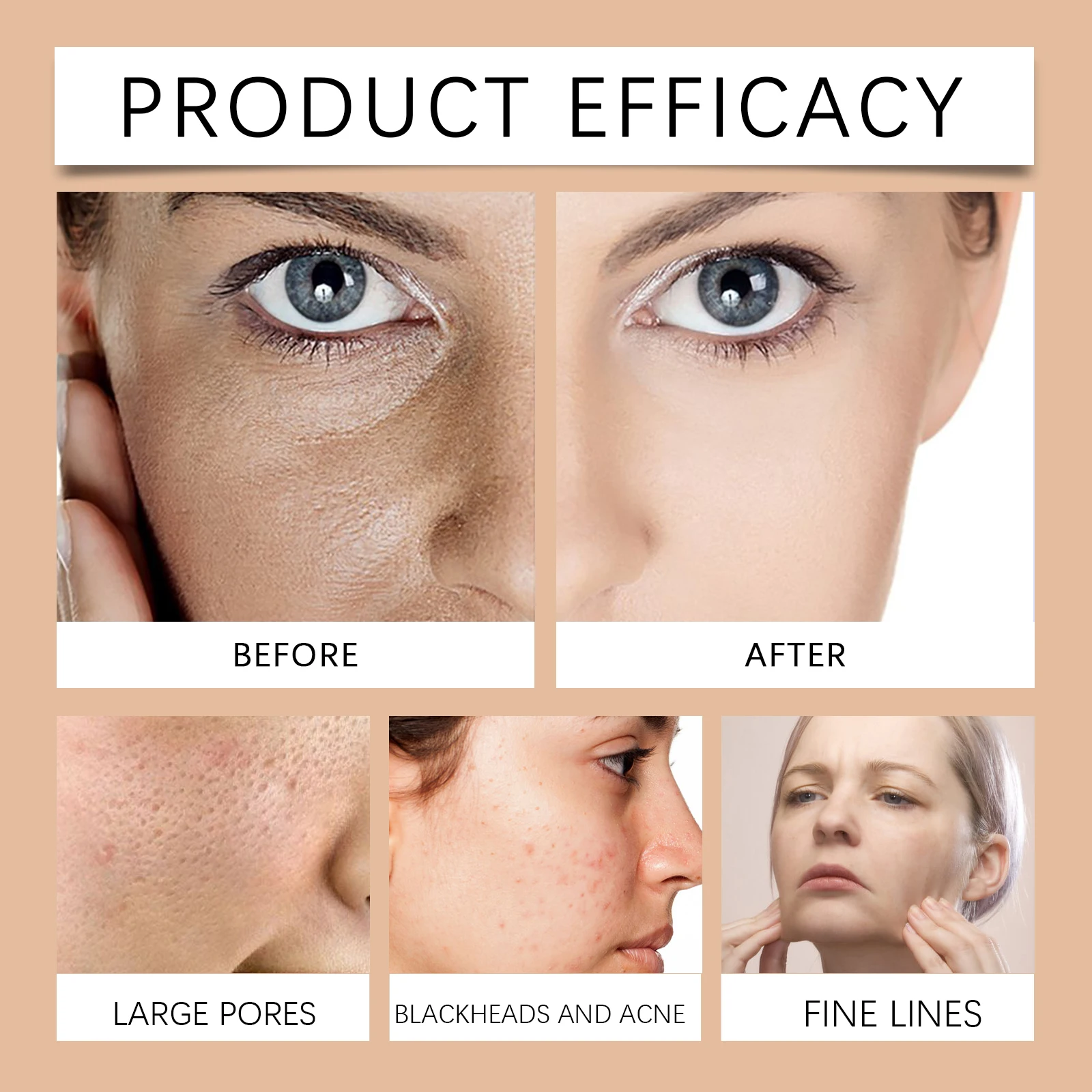 HOYGI Lighten Spots Peel-Off Mask Cleaning Pores Brightening Freckle Anti-Blemish Even Skin Tone Moisturizing Firm Facial Mask