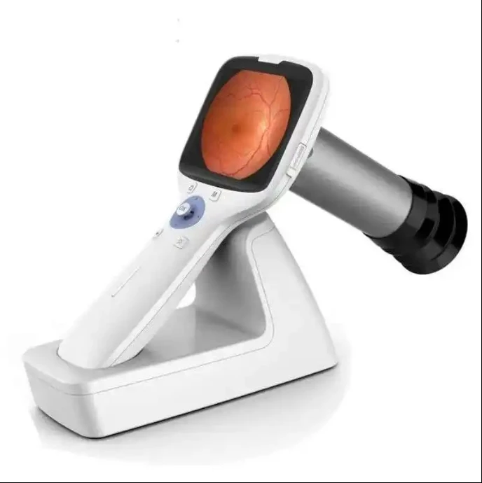 Fundus Camera Using Mobile Phones Nes-1000 Automatic Fundus Camera for Eye Test