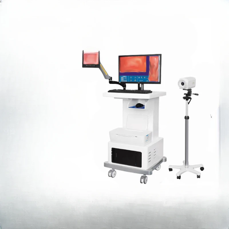 6000Y dual-screen digital electronic colposcope 300W pixels