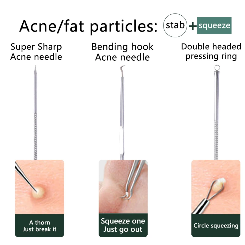 Set da 4 pezzi di aghi per la rimozione dell'acne, set di aghi per l'acne ultrafine, rimozione dei punti neri, spremitura e strumento per la pulizia