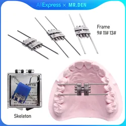 Wysokiej jakości Dental ortodontyczne spiralne śruby ekspandera stal nierdzewna szybki Palatal typ regulowany spiralny łuk fortechnicy