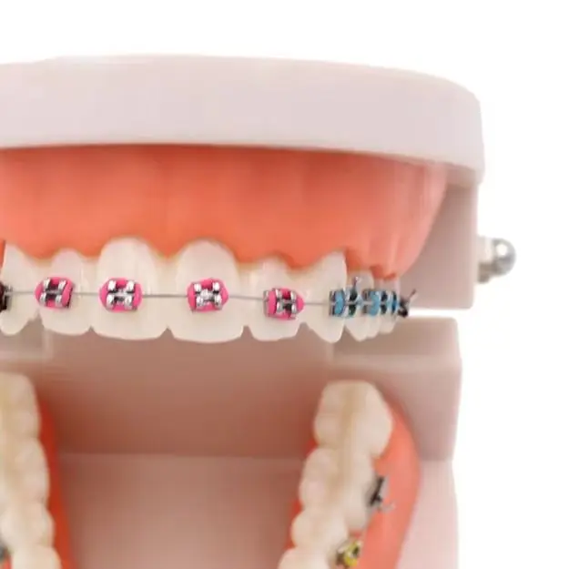 

Dental Orthodontic Treatment Model with Ortho Metal Bracket Arch Wire Buccal Tube Ligature Ties