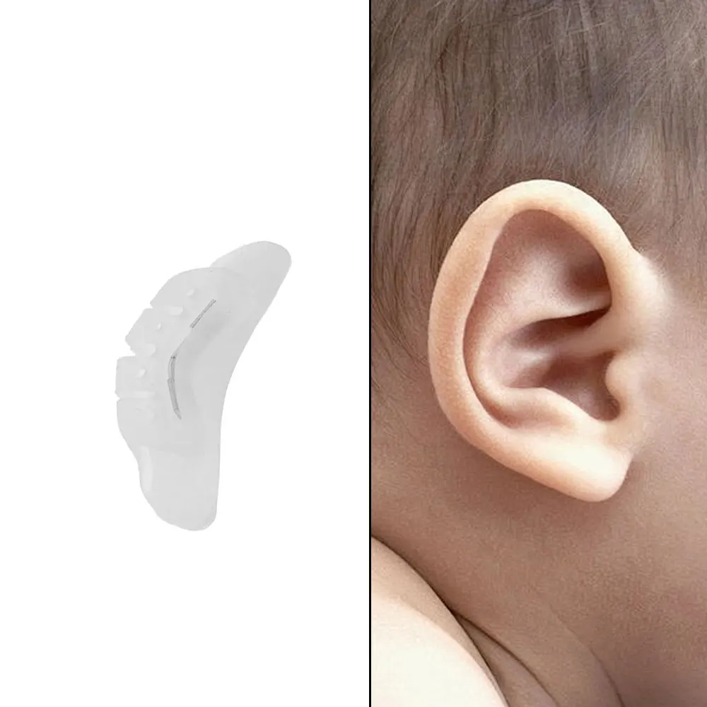 Protruding Ear Support Infant Corrector Tools Silicone Auricle Correction Patch For BabyEar Corrector Baby Auricle Valgus Kit view 5