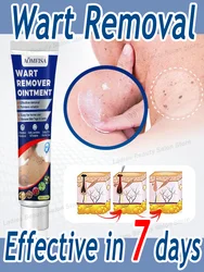 Make your wart-free life comfortable, suitable for everyone and effective, fast results