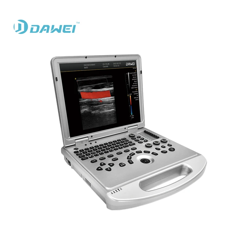 primary care Diagnostic Ultrasound Scanner Medical Equipment DW-L3