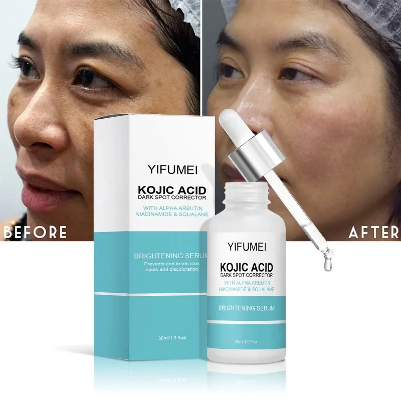 

Crown Diamond Niacinamide Arbutin Hydrating Skin Brightening Moisturizing Dark Spot Facial Serum Kojic Acid Women Skin Care