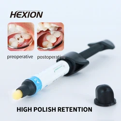 Dental Light Cure Nano-Hybrid Composite Resin 4g/pc Dental Composite Syringe Resin for Perfectly Restored Teeth Resin Composite