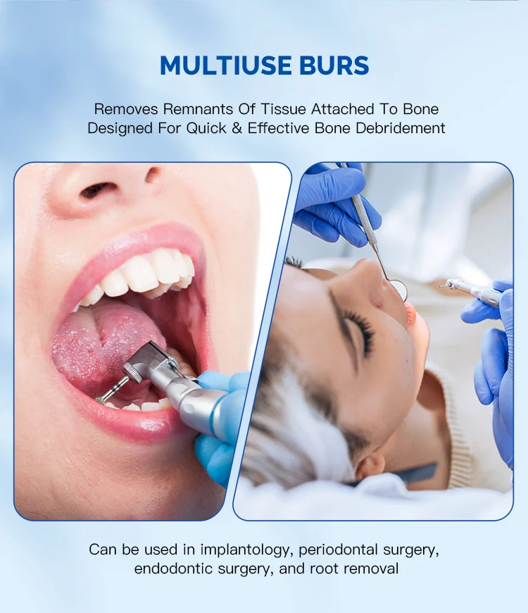 AZDENT Dental-Degranulationsbohrer-Set, runde Kugel-Fräserbohrer zur Entfernung von Geweberecken, Knochen-Debridement, Diamantbeschichtung, Zahnmedizin – Detail 4