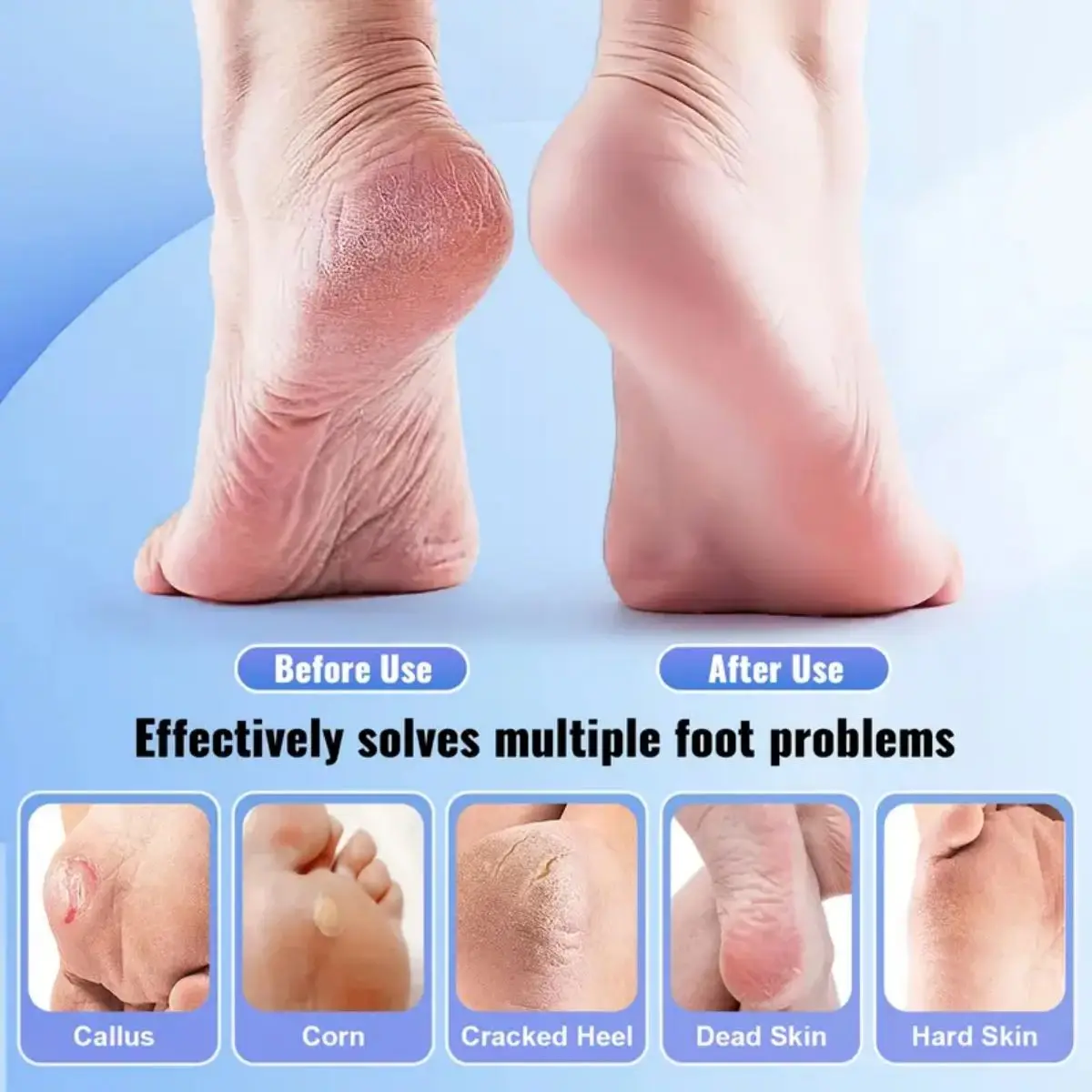 Ensemble de pierres de verre violet pour épurateur de pieds, dissolvant de callosités de poulet, dissolvant de peau à fréquence d'extinction douce, épurateur hypoallergénique, 10 pièces