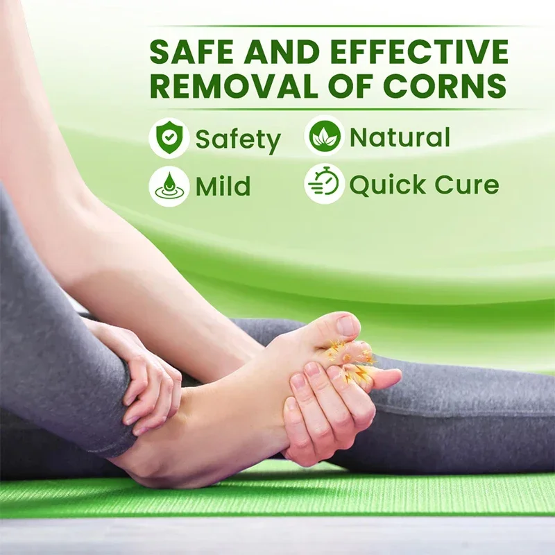 Foot Corn Remover Cream Chicken Eye Skin Infection Treatment Ointment Feet Dead Skin Calluses Removal Tool Health Care 발톱무좀