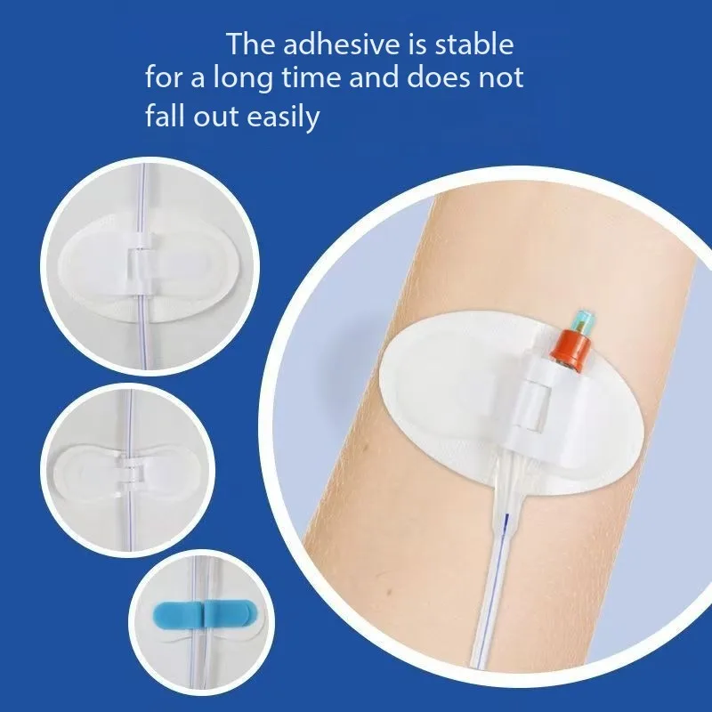 

Наклейка для фиксации однотрубной трубы, универсальная наклейка для фиксации трубы, наклейка для крепления двухкамерной дренажной трубы