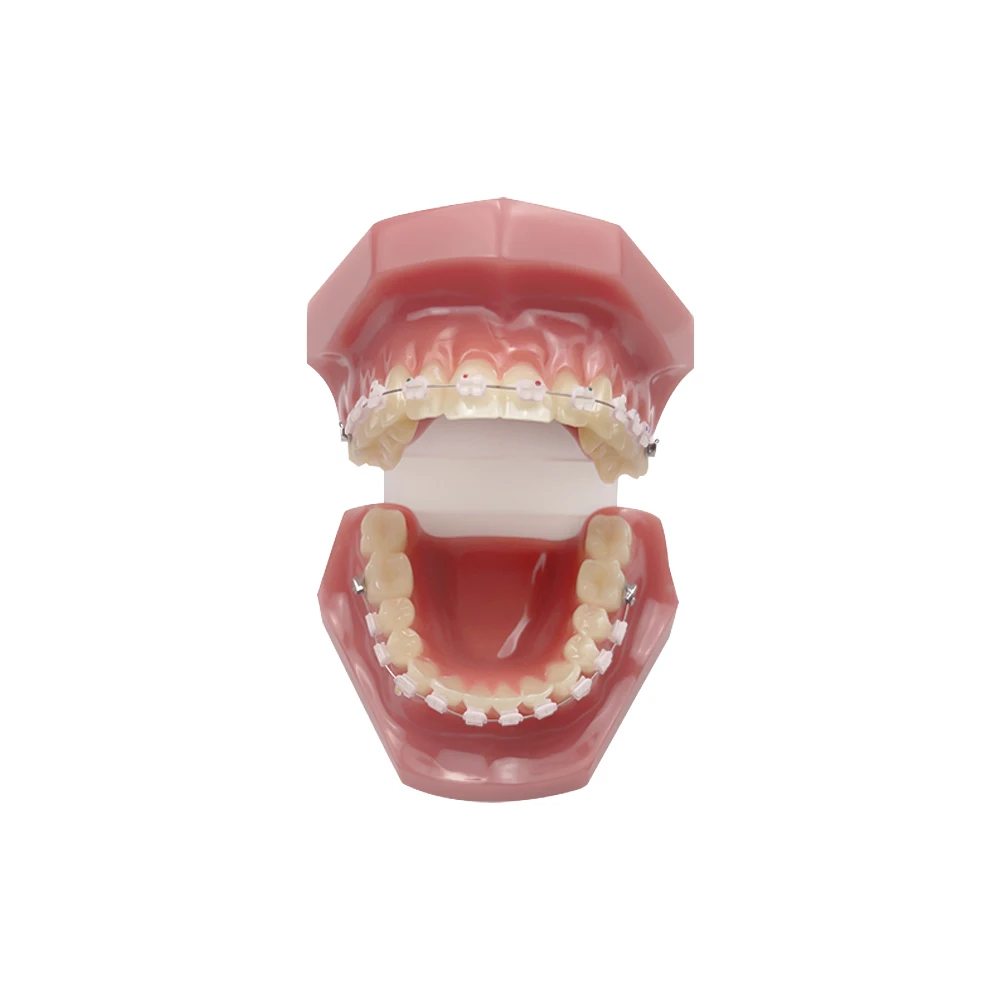 Orthodontic Teeth Practice Model All Ceramic Orthodontic Model for Dental Technician Teaching Training Studying Communication