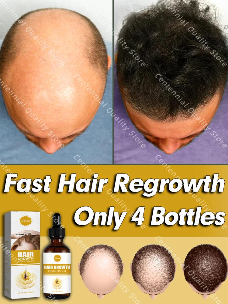 

Hot selling product, 99% of buyers buy again, have more and more hair, say goodbye to baldness, thick hair