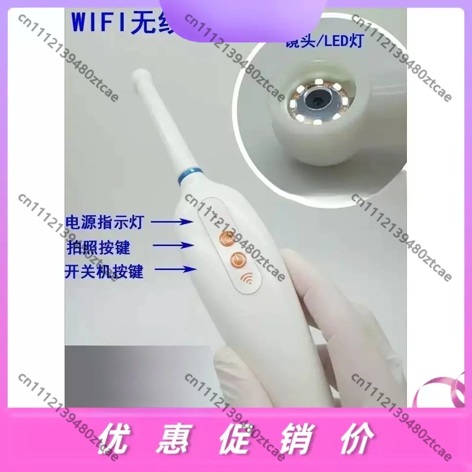 Wireless WiFi Dental Intraoral Camera Rotatable Rechargeable Oral Endoscope, Clear Image For Phone & Pad Dental Clinic