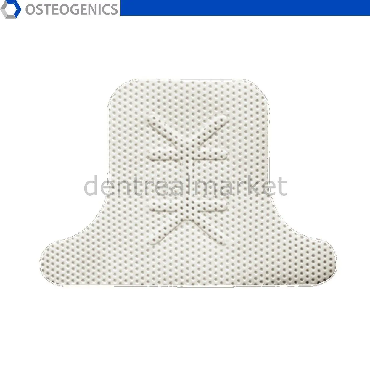 Osteogenics - Cytoplast Titanium-Reinforced Non-Resorbable High-Density PTFE Membranes - Posterior Singles  T2 25*36 mm