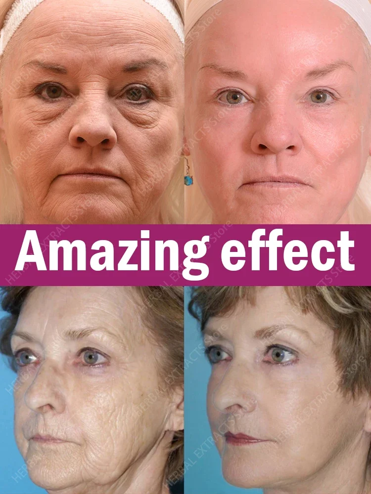 

Anti Wrinkle Aging Instant Effect Remove Facial Wrinkles