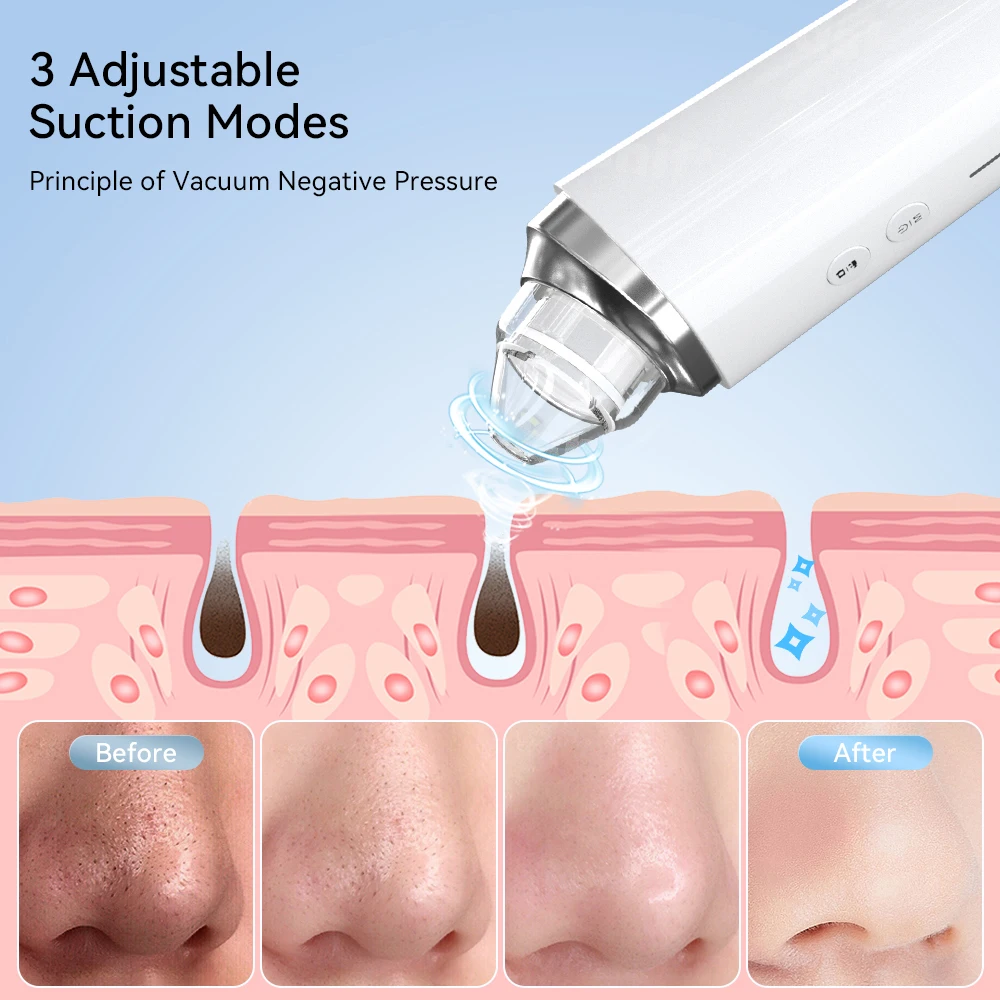 Vacuum Acne Cleaner Electric Blackhead Remover Black Head Removal Facial Deep Cleansing Pore Cleaner Machine Skin Care Tools