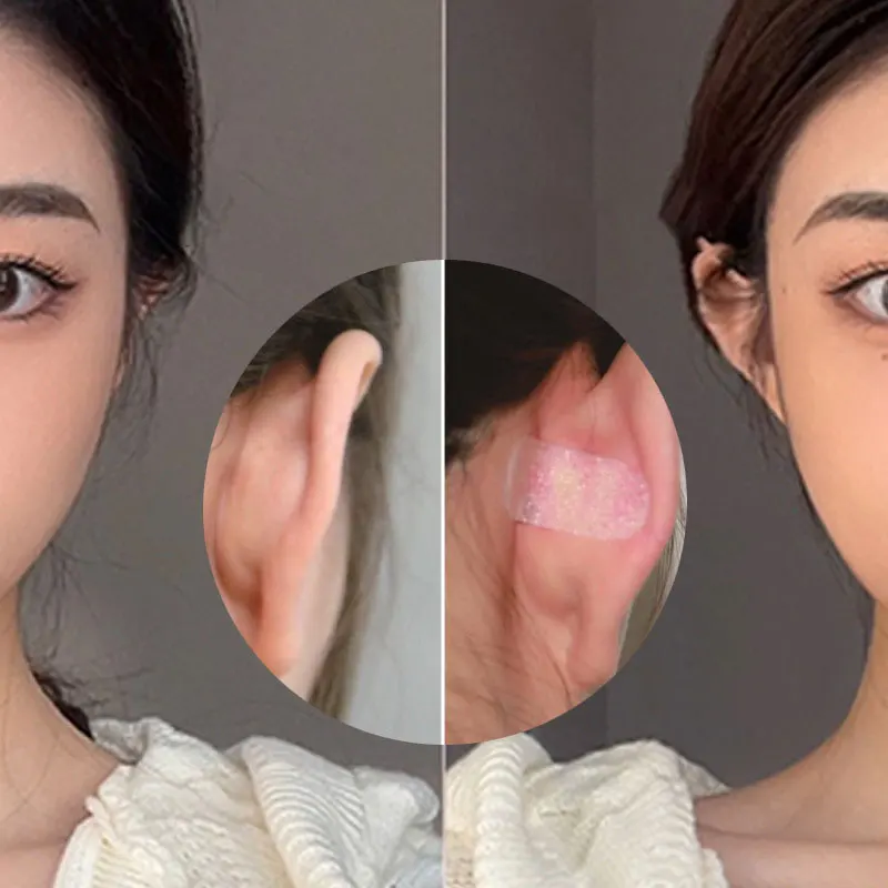 Vertical Stand Ear Stickers, Orelhas folheadas se tornam correção de orelha, Ear Stickers