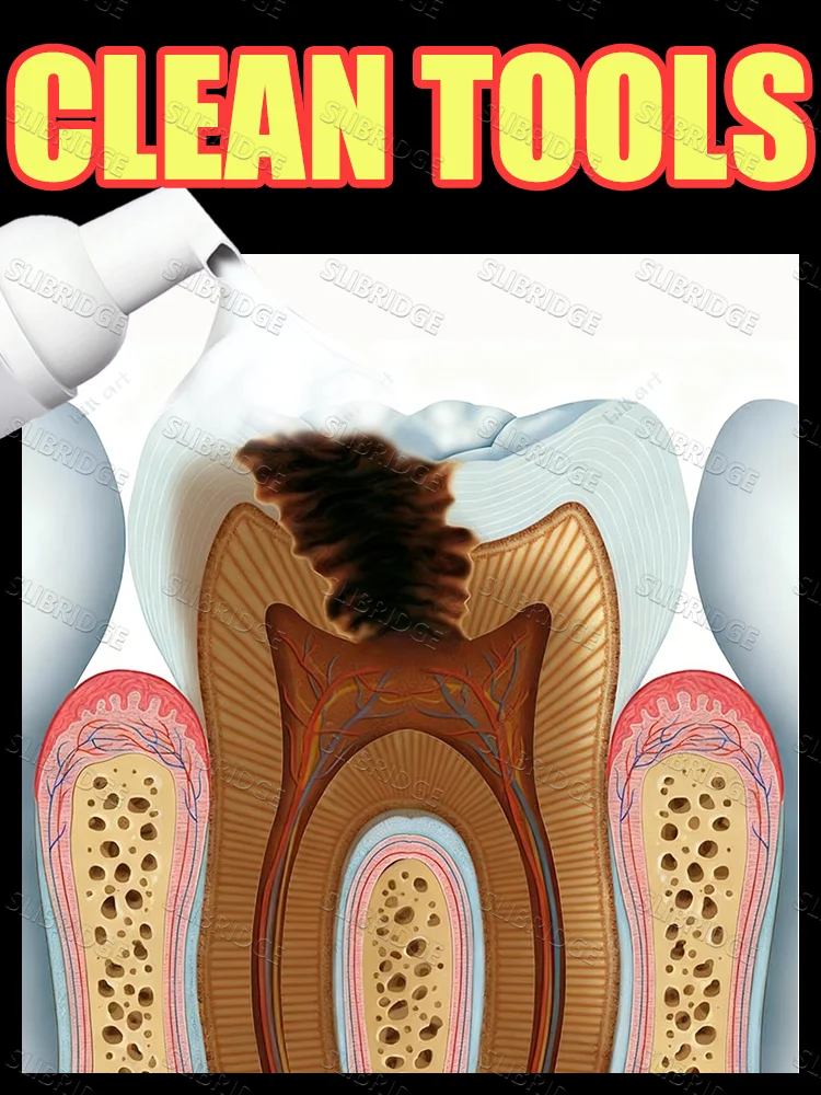 

Bestseller in [Japan],Generation-2 anti-cavity foam mousse,Tooth decay prevention,dental cleaning tools,free shipping