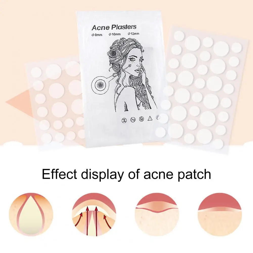 Patch per brufoli da 72 pezzi, sicura, ad assorbimento rapido, compatta, rapida, invisibile, per l'acne, per le donne