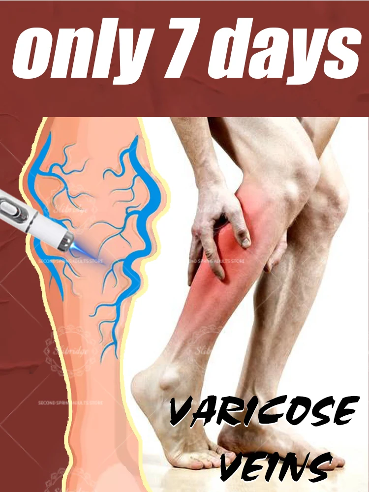 

blue light upgraded style Says Goodbye To Spider Legs Varicose In 7 Days