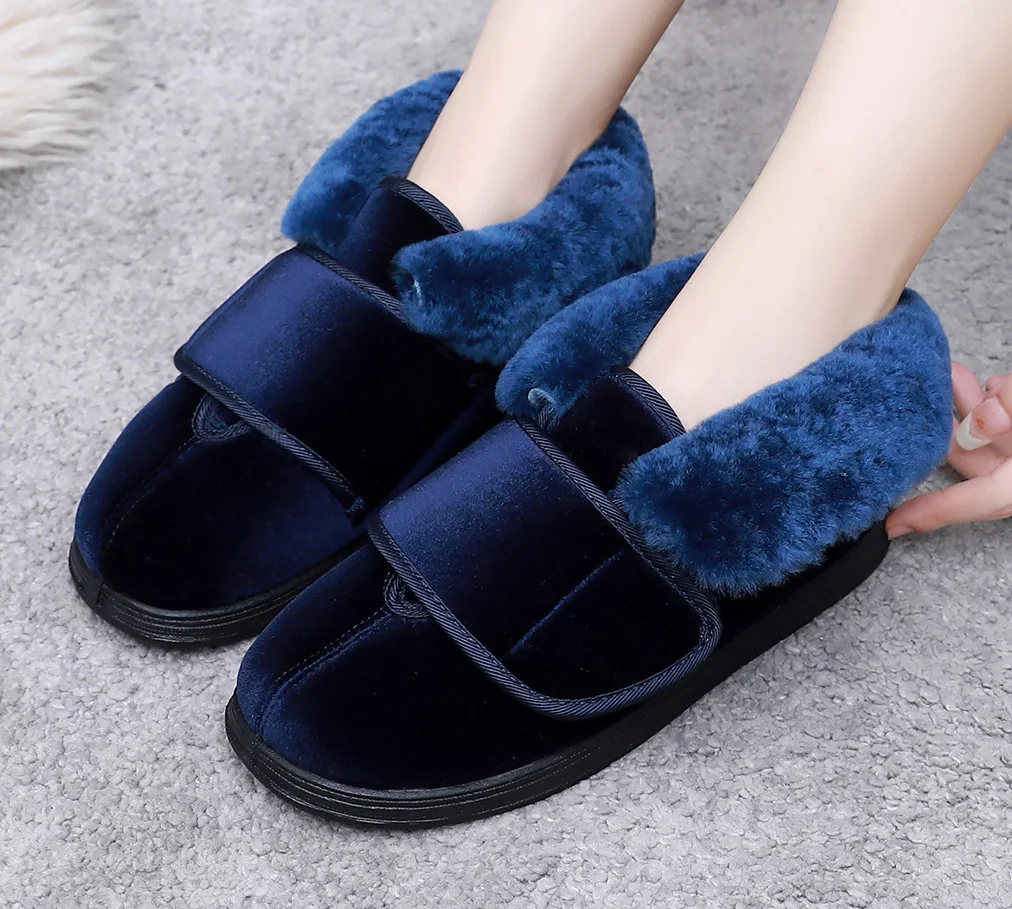 New Widening Adjustable Warm Real Hair Neckline Fashion Swollen Pregnant Women Drivers Diabetes Fat Foot Cotton Shoes