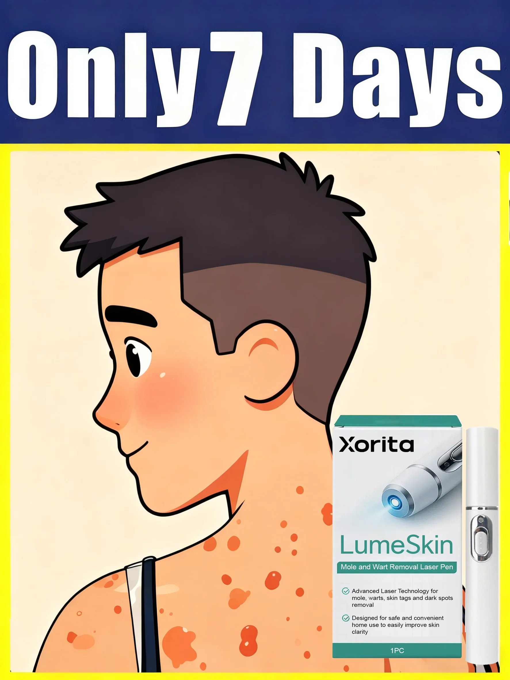 الجيل الثاني من الثآليل المطورة بسرعة، إصلاح جذر الثآليل الجديدة #1