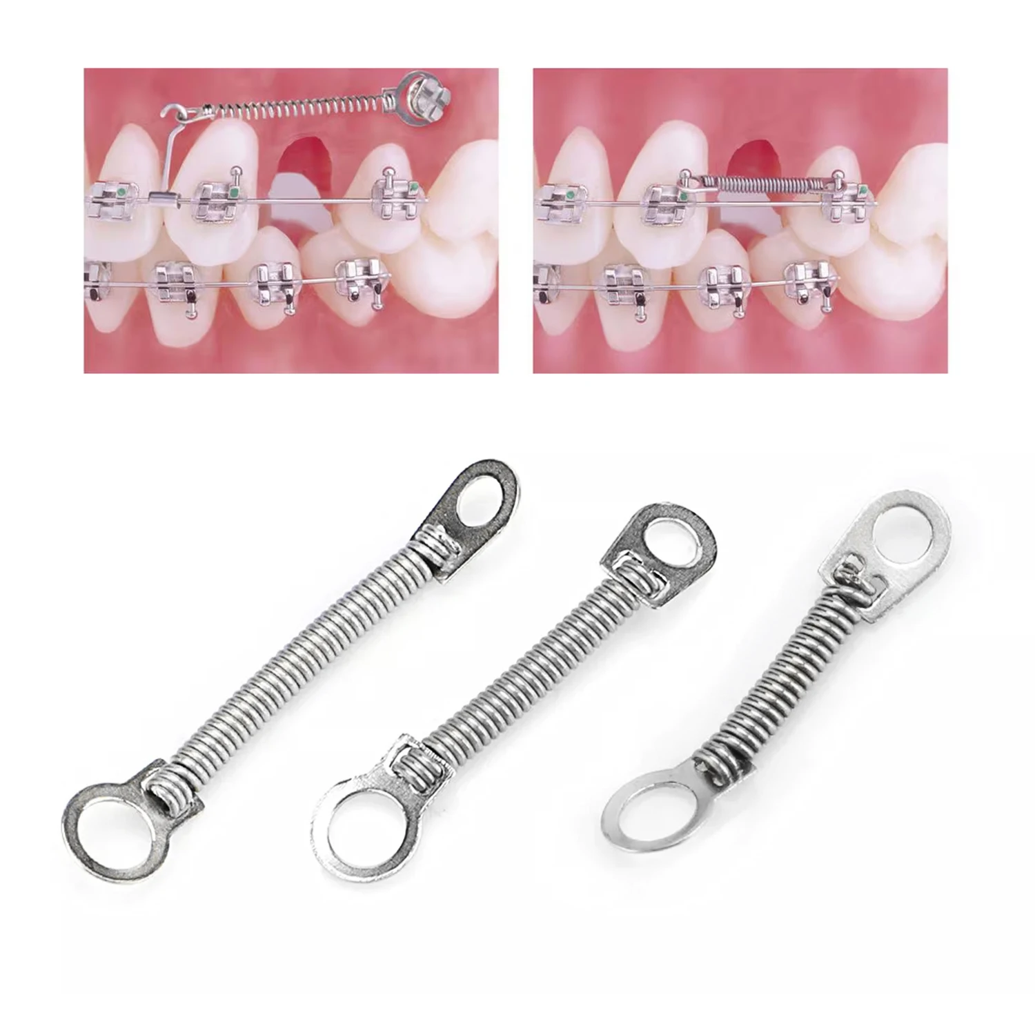 10pcs/Pack JOLANT Dental Orthodontic Close Coil Spring Niti Anterior Teeth Tooth Torque with Big Pull Ring 0.010/0.012\