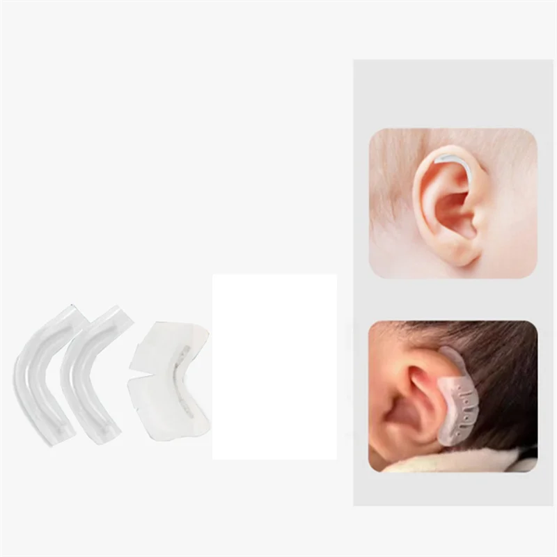 AS96-Płaster korygujący wybrzuszone uszy, wsparcie dla wybrzuszonego ucha, korektor dla niemowląt, korektor zewnętrznego wybrzuszonego ucha dla dzieci B
