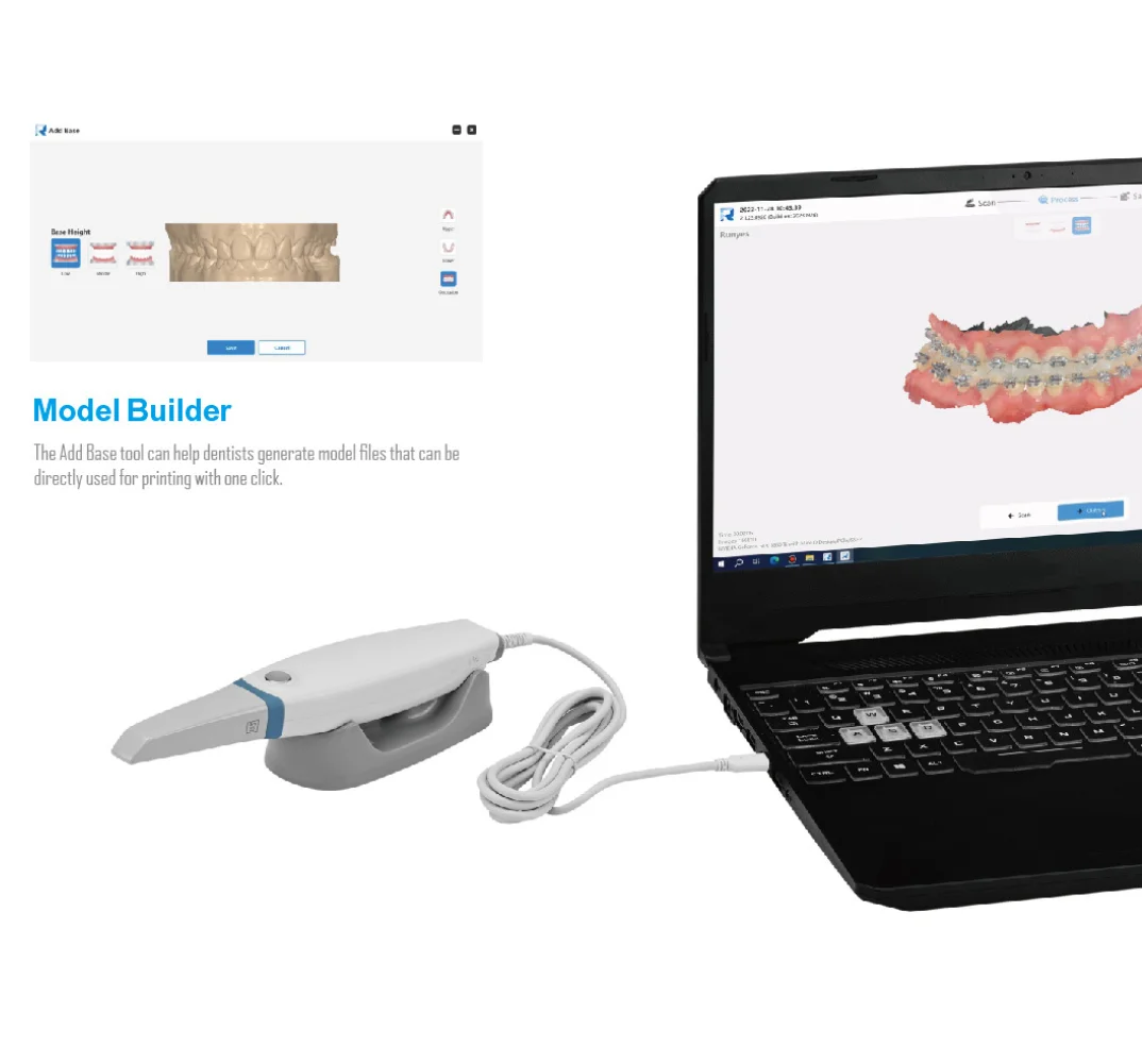 2026 NEW Dental Intraoral Scanner 3DS V3 Pro Ios-11 With Free Software Calibration Free Cmos Technology Type-C Port