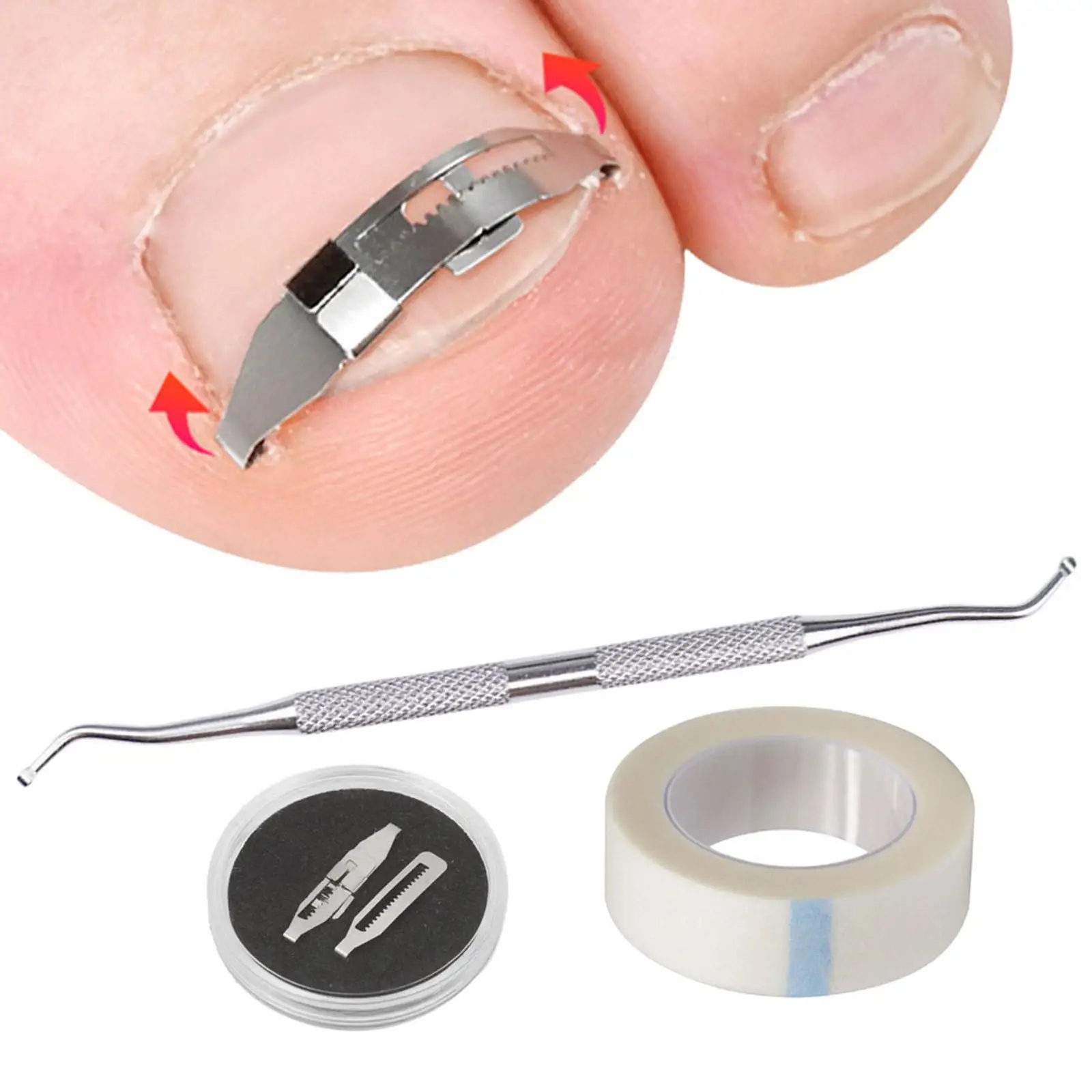 Professionele ingegroeide teennagelcorrectorhulpmiddelen Ingebouwde teennagelsbehandeling