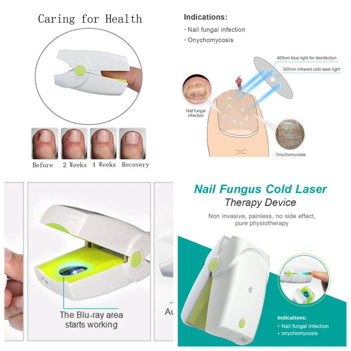 

Rechargeable Nail Fungus Laser Pen Device for Professional Toenail Fingernail Treatment