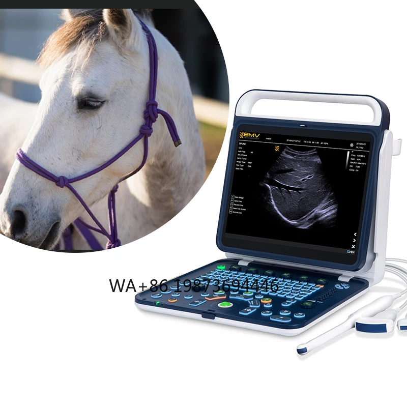 Экономичный раскраризованный сканер высокой четкости для диагностики печени для лоней