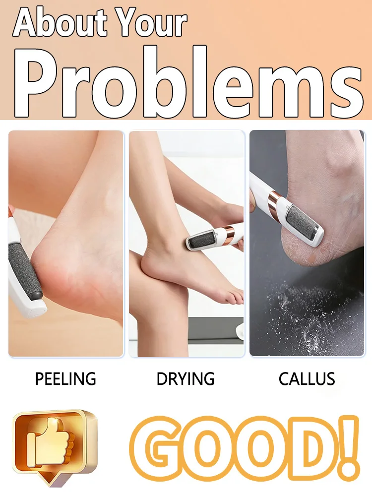 Thumbnail 3 - #6 Latest Foot Scrubbers Offers