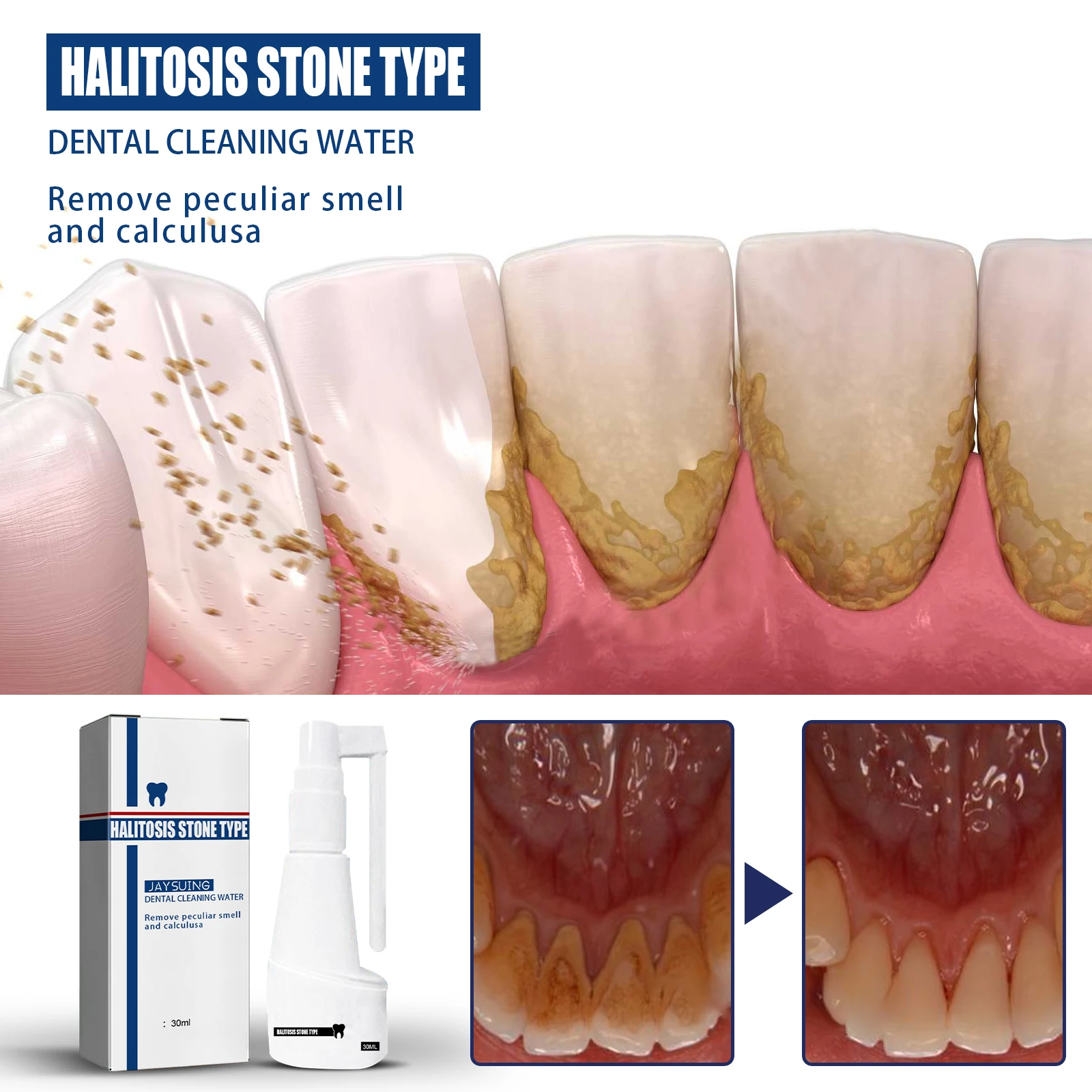 

5 Day Teeth Whitening Serum Remove Plaque Stains Dental Calculus Oral Hygiene Cleaning Fresh Bad Breath Spray Tooth Care Product