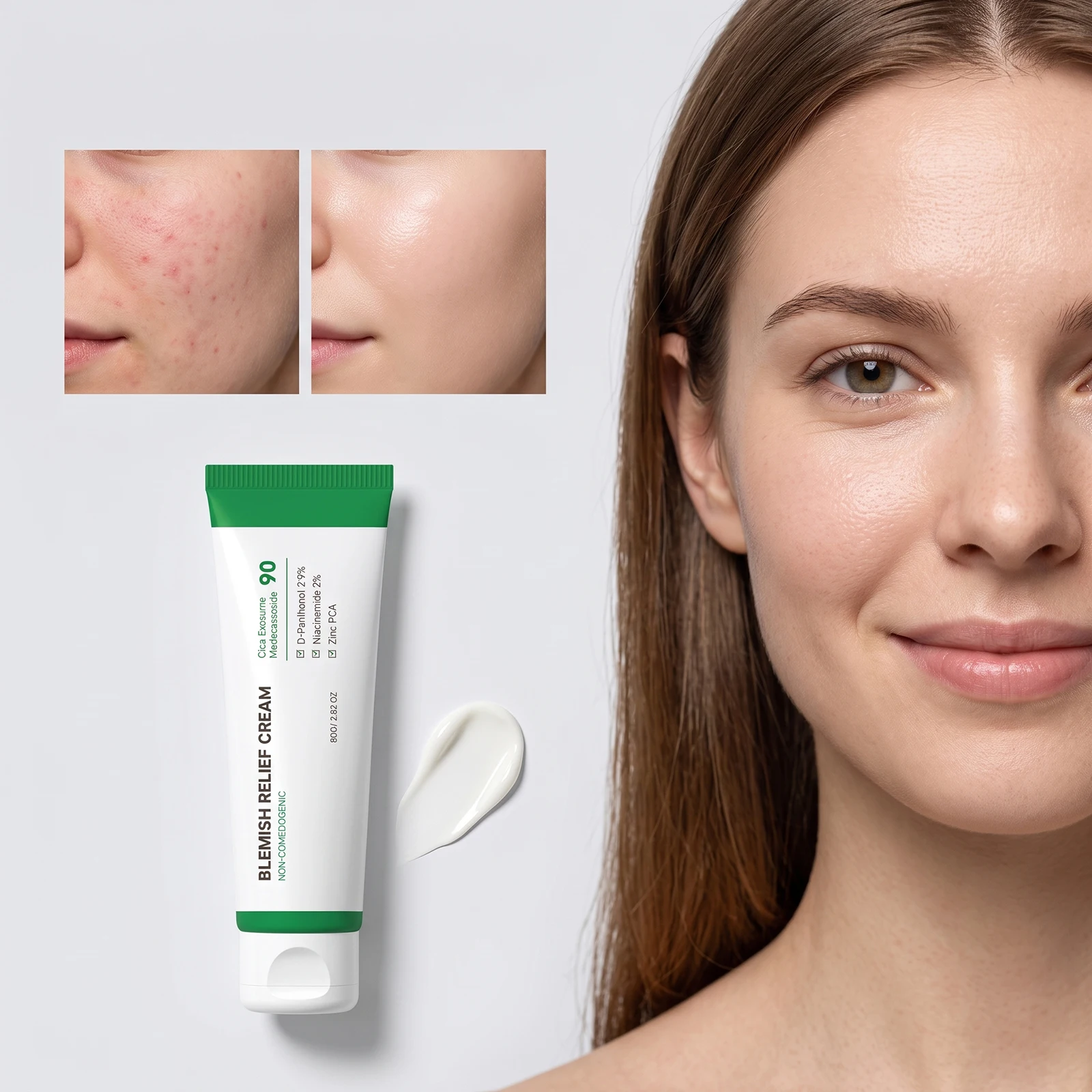 Centella Asiatica Face Cream For Redness & Blemish-Prone Skin,Reduce Acne Pimple Repair Face Skin Barrier CICA Face Moisturizer