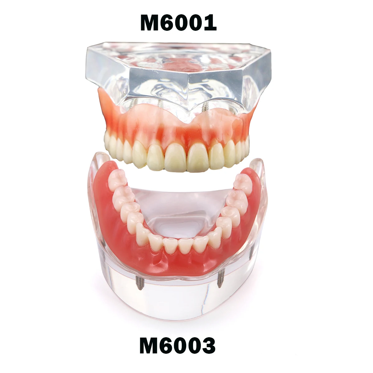 Dental Model Teeth Implant Restoration Dental Prosthesis Model   For Dentist Patient Communication Treatment Study Demo