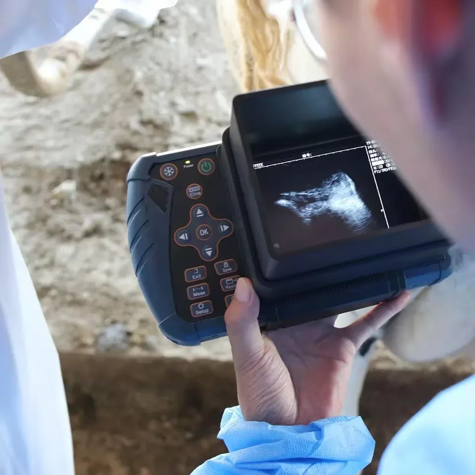 Highest Cost-effective Handheld Portable 3 in 1 Wifi & USB Wireless Ultrasound Probe