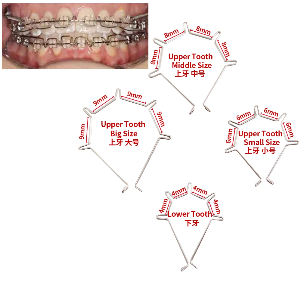 

10Pcs/Pack Dental Orthodontics Five Curved Torque Spring Auxiliary Arch Wire Big Middle Small Dentist Materials