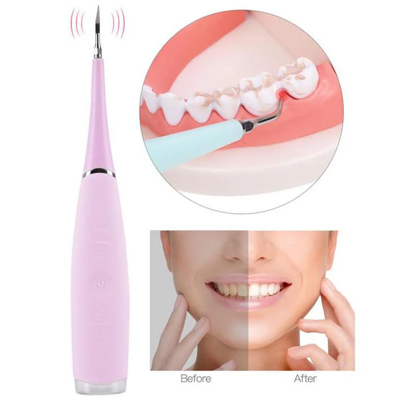 Portable Electric Sonic Dental Scaler Tooth Calculus Remover Tooth Stains Tartar Eraser Home Use Toothwash Tool