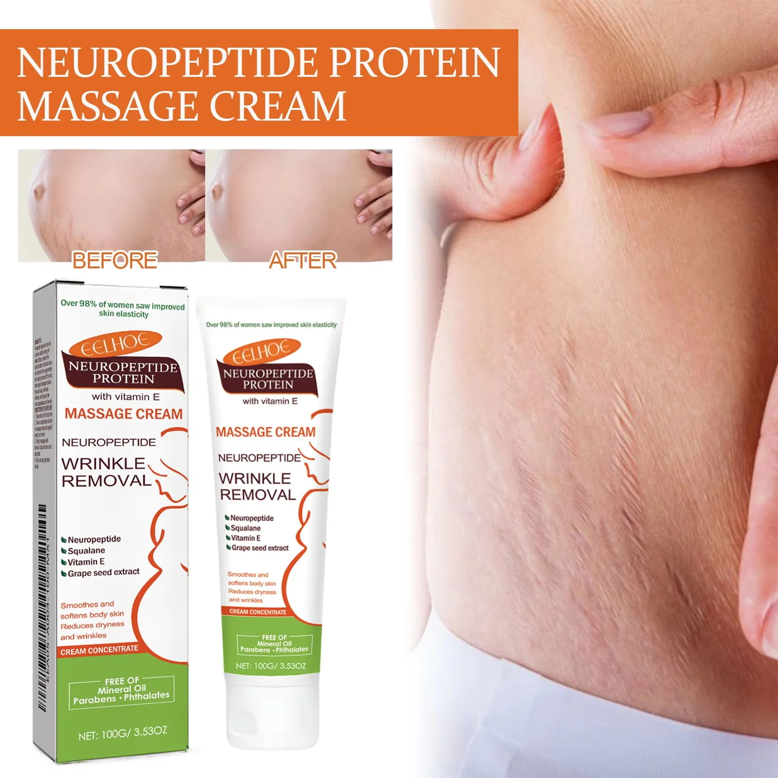 100g Stretch Marks Permanent Removal Cream Maternity Pregnant Women Pregnancy Anti-Winkle Smooth Repair Firming Skin Body Care view 2