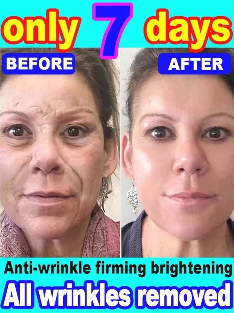 

Instant Anti Wrinkle Aging Effect Remove Facial Wrinkles cream To Fine Lines Around The Eyes Crow's Feet Neck alo beauty-health