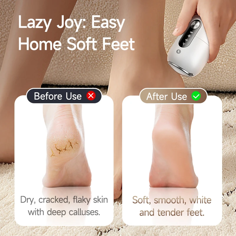 Mini Electric Foot Grinder Pedicure Tools Used for Polishing Thick Calluses on The Sole of The Foot Portable Remover Foot Tool