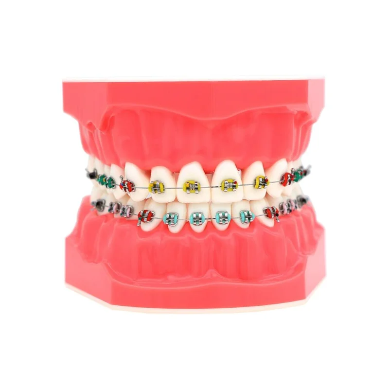 

Dental Orthodontic Model with Bracket Arch Wire Ligature Tie 1:1 Standard Size Teeth Model Typodont Demo for Patients Students