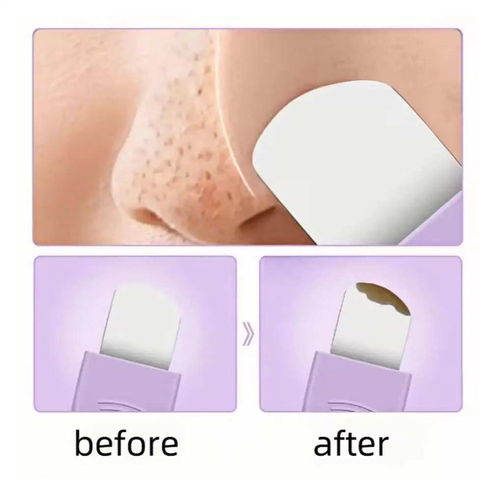 Outil d'élimination des points noirs, épurateur de visage en Silicone, grattoir 2 en 1 pour le nettoyage en profondeur, spatule pour la peau du visage, nez noir H