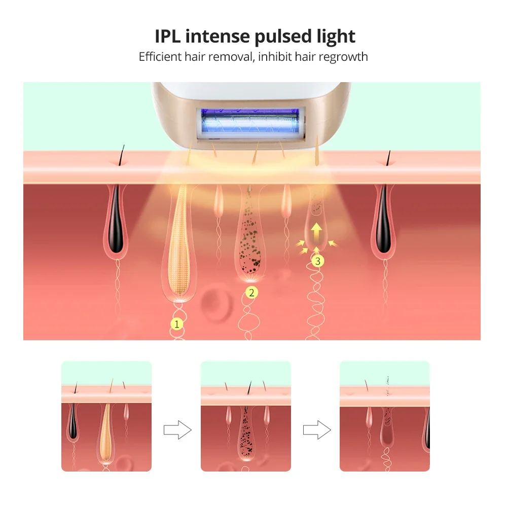 Appareil d'épilation au laser IPL, usage domestique, continu et indolore, 999999 flashs